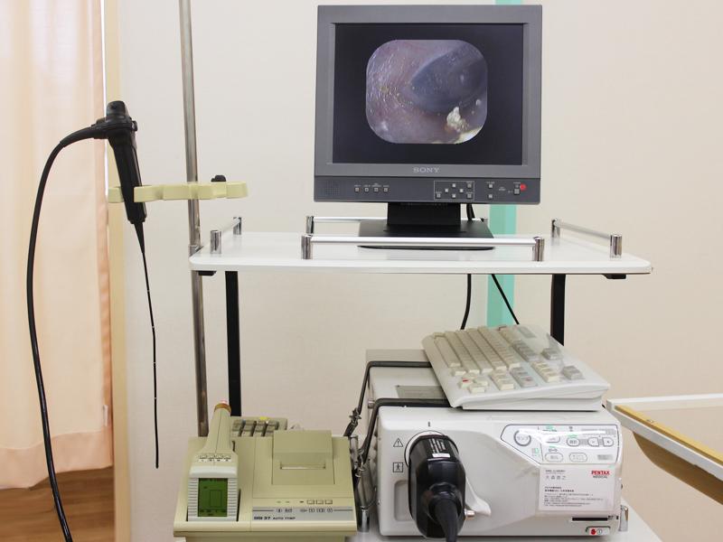 電子ファイバースコーピー